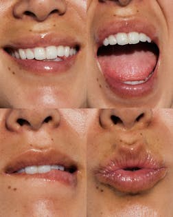 Hyaluronic Lip Booster