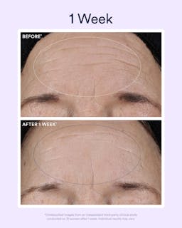 Dream Night Serum with Bio-Retinol