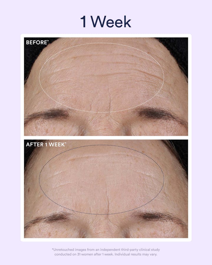 Dream Night Serum with Bio-Retinol