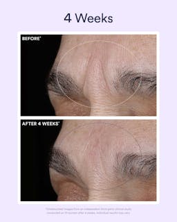 Dream Night Serum with Bio-Retinol