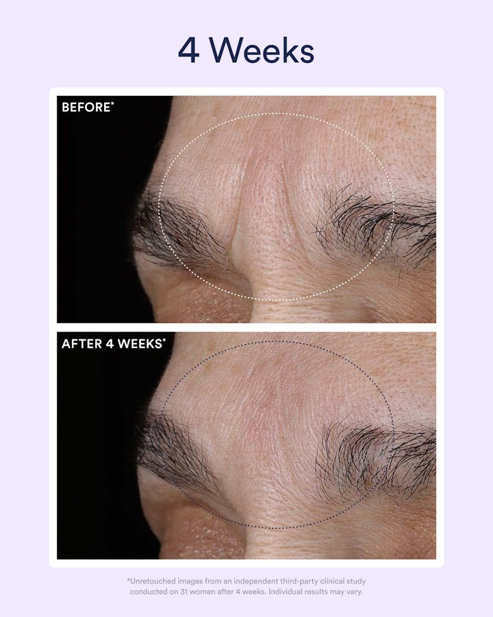 Dream Night Serum with Bio-Retinol