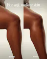 Before and after comparison of soft, radiant skin on a person's arm.