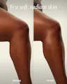 Before and after comparison of soft, radiant skin on a person's arm.